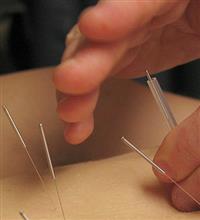 What can Acupuncture treat?